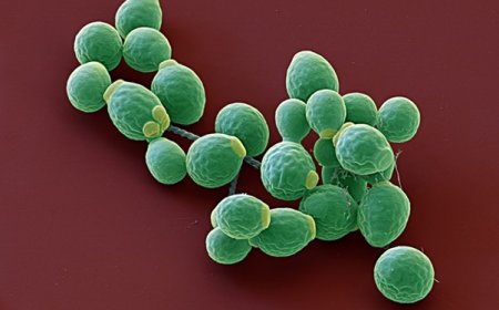 Could antifungals be the answer to severe COVID inflammation ?