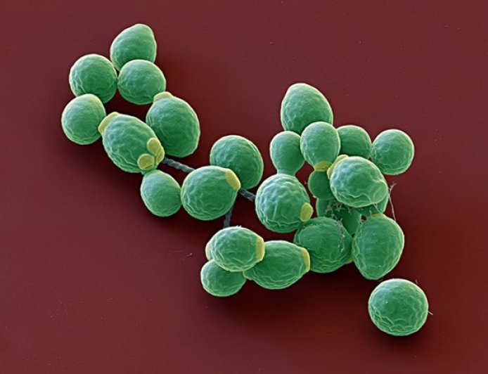 Could antifungals be the answer to severe COVID inflammation ?